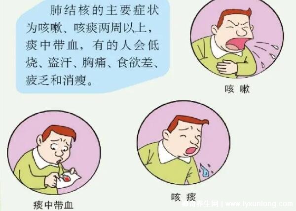 三個徵兆說明已有肺結核咳嗽超兩週且咳痰帶血需警惕